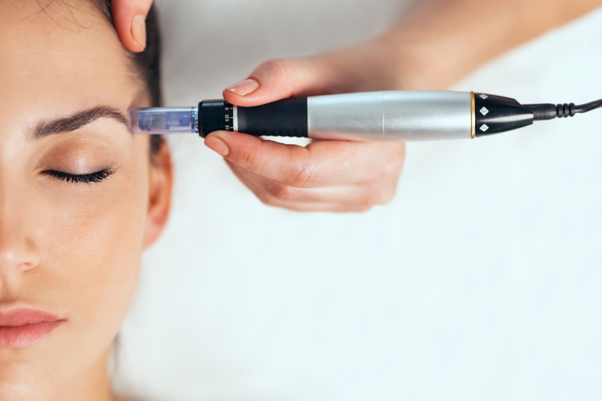 Microneedling-Stift an der Schläfe